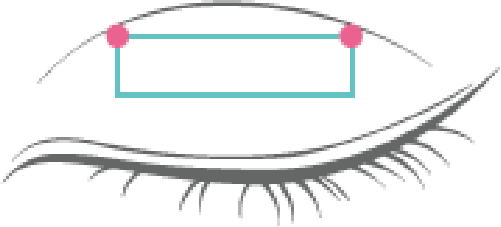 2点固定のシェーマ